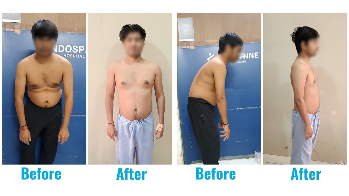 A 31-year-old who lived on a chair… until his spine finally said, ‘Enough’